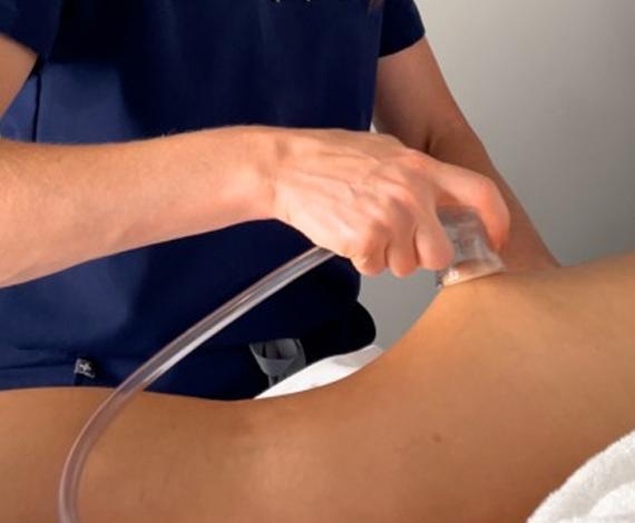 DermaShape lymphatic therapy during a treatment session